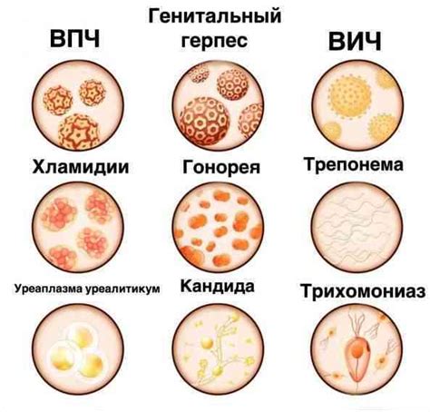 Защита от Половых Болезней