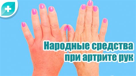 Лечение опухшего пальца: народные средства и медицинская помощь