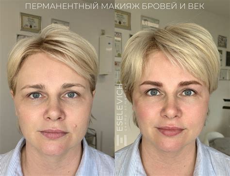 Основные преимущества сочетания ламинирования и межреснички