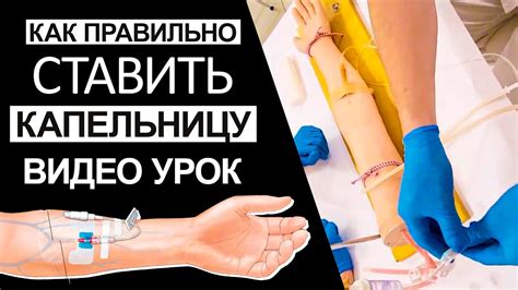 Правильное закрепление капельницы на холке