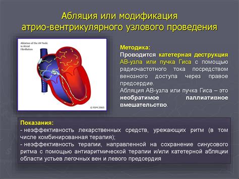 Преимущества ходьбы при аритмии