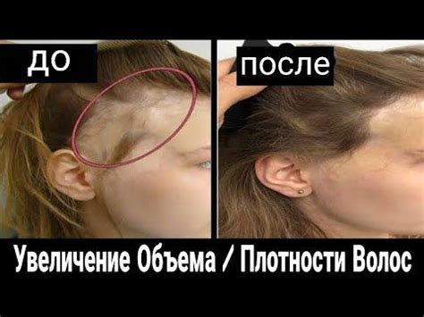 Причины недостаточной густоты