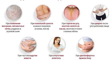 Симптомы избытка паратгормона
