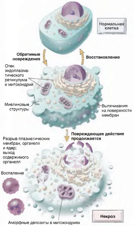 Синеция и некроз