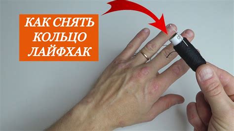 Физиологическое значение опухшего пальца
