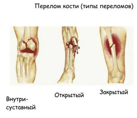 Характеристика травмы