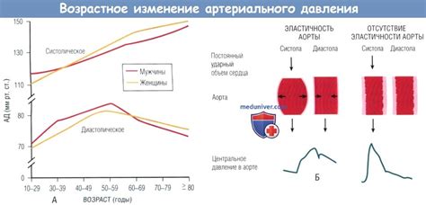 Четвертый аспект ухудшения давления