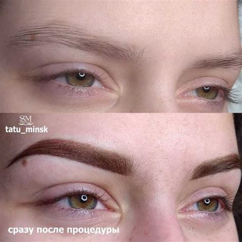 Альтернативные методы осветления