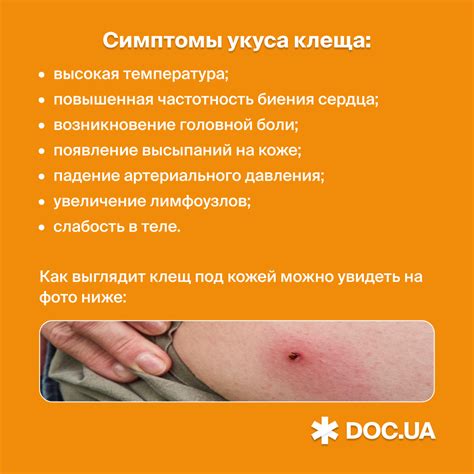 Ближайшие места для обращения в случае укуса клеща: