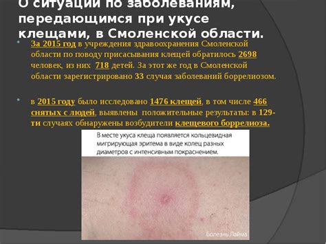 Специализированные центры по заболеваниям, передаваемым клещами: